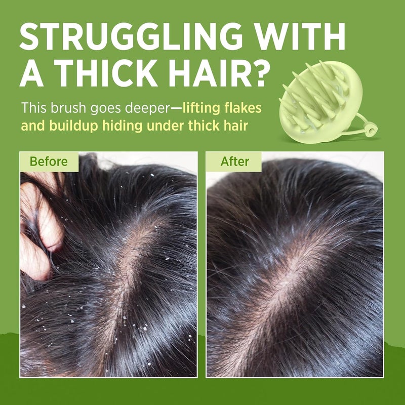 Roycederm Scalp Massager Brush Hair Scrubber – Soft Silicone Shampoo Brush for Scalp Care, Itchy Relief & Deep Cleansing – Ideal for Dandruff, Seborrheic Dermatitis & Scrub Use - Image 4